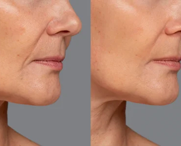 Good Life aesthetic and regenerative treatment results