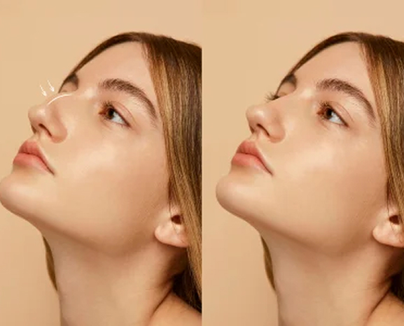 Good Life aesthetic and regenerative treatment results